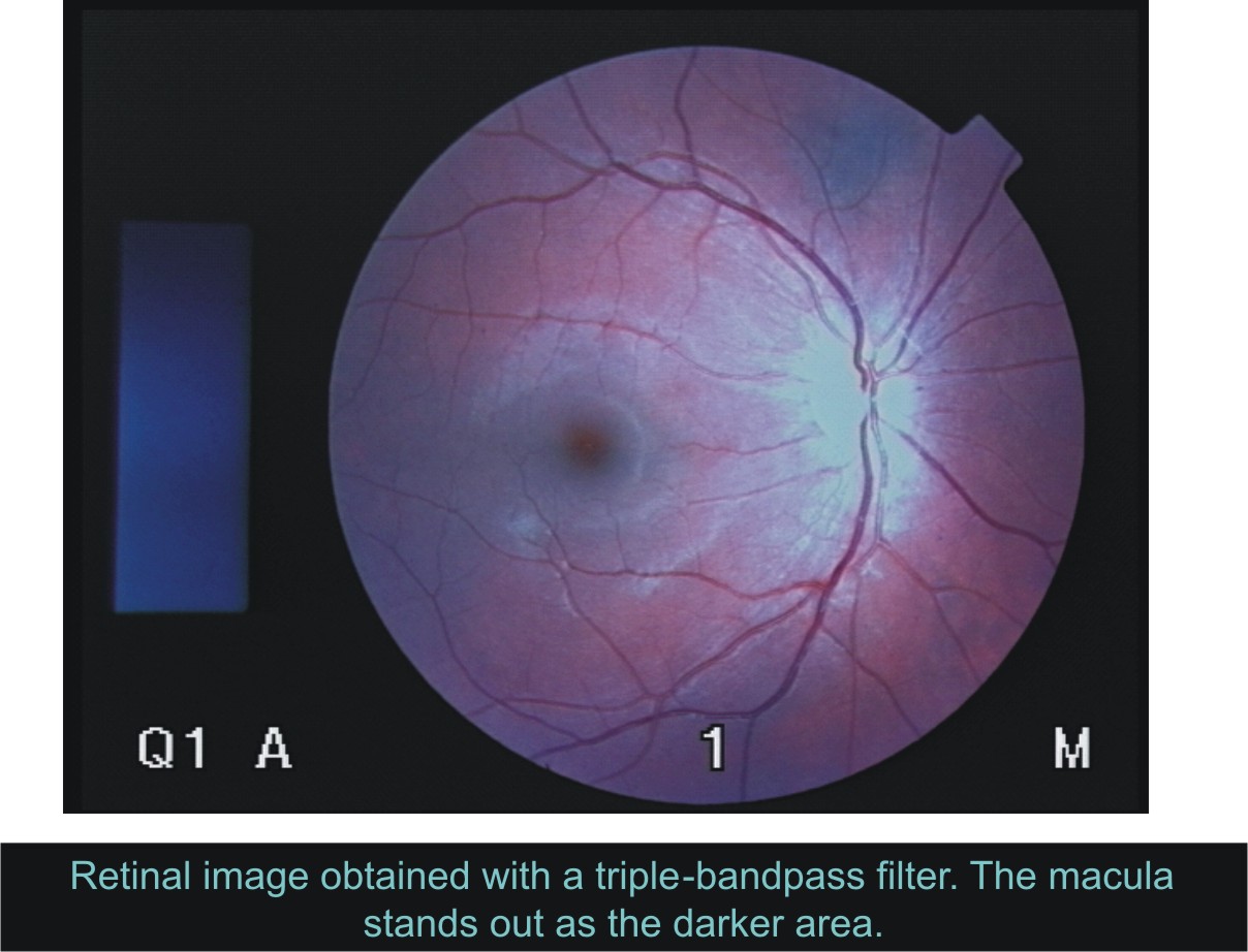 Retinal image with triple band filter